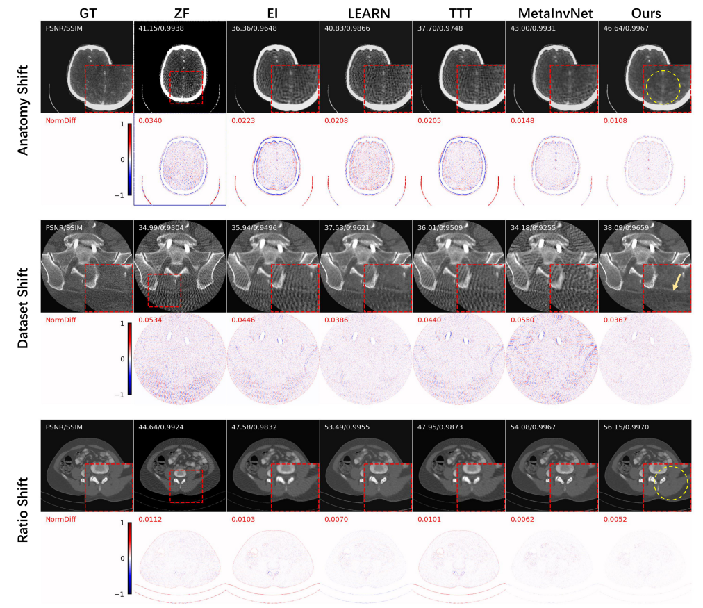 Test-time Adaptation via Orthogonal Meta-learning for Medical Imaging