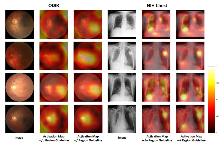 Trustworthy Disentangled Framework for Multi-Label Medical Image Classification with Multimodal Refinement