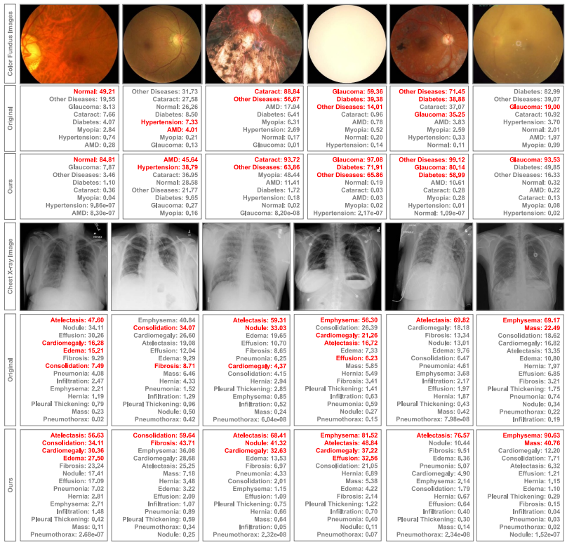 Multi-label Medical Diagnosis using Spatial-disease Feature Condensation and Kolmogorov–Arnold Layers